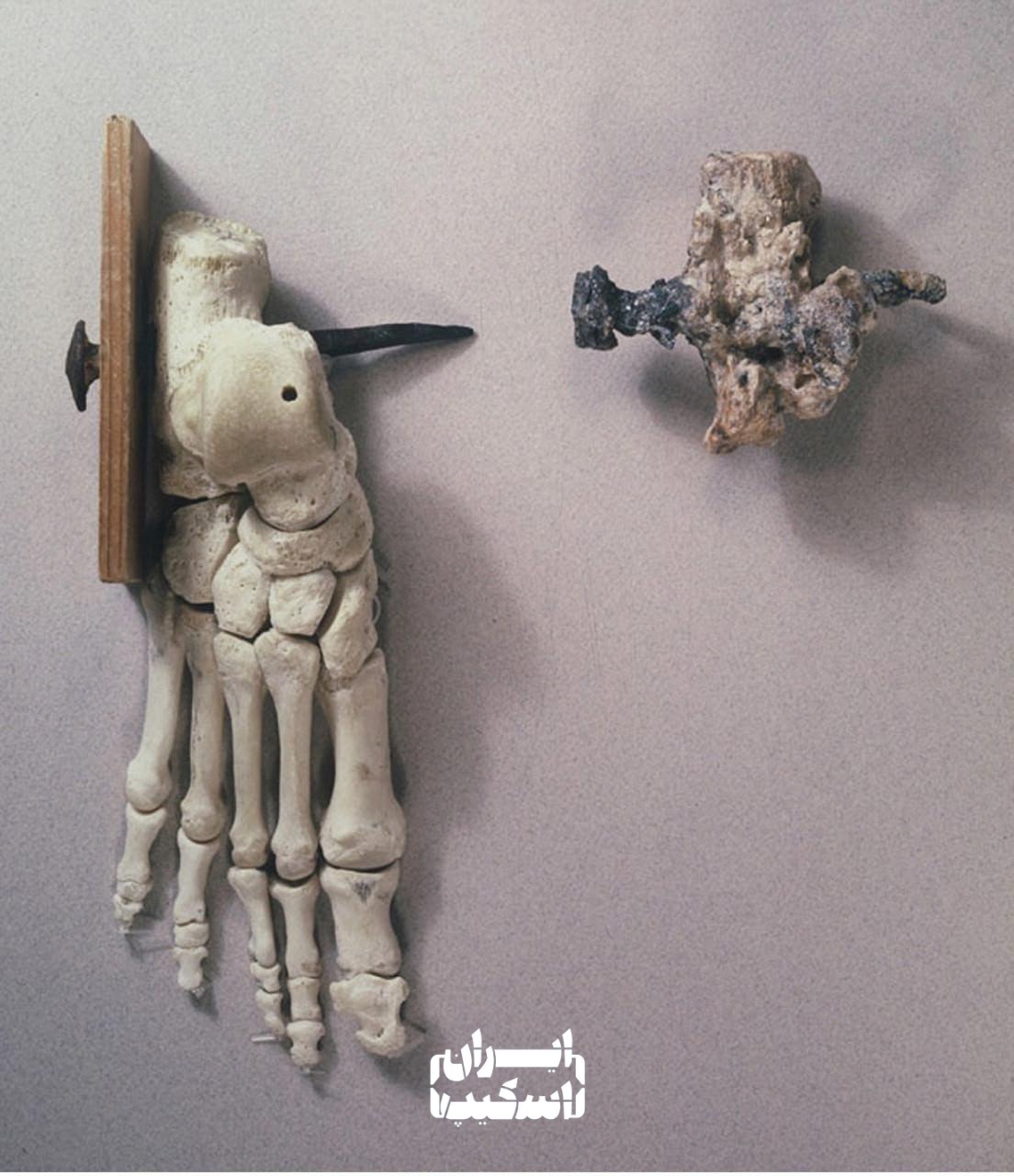 استخوان پاشنه مرد مصلوب شده با میخ آهنی در دوره روم